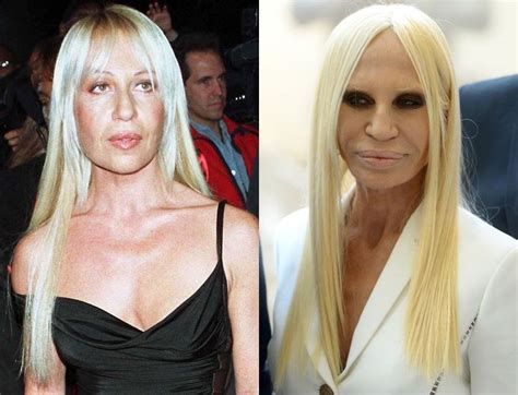 donatella versace cambiamenti|donatella versace before and after surgery.